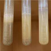 Suspensions with large particles are difficult to stabilise, in this image we see three different dilutions which have all undergone settling.